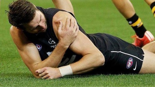 Joueur de football australien – luxation de l'épaule